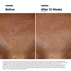SkinCeuticals Hyaluronic Acid Intensifier Multi-Glycan