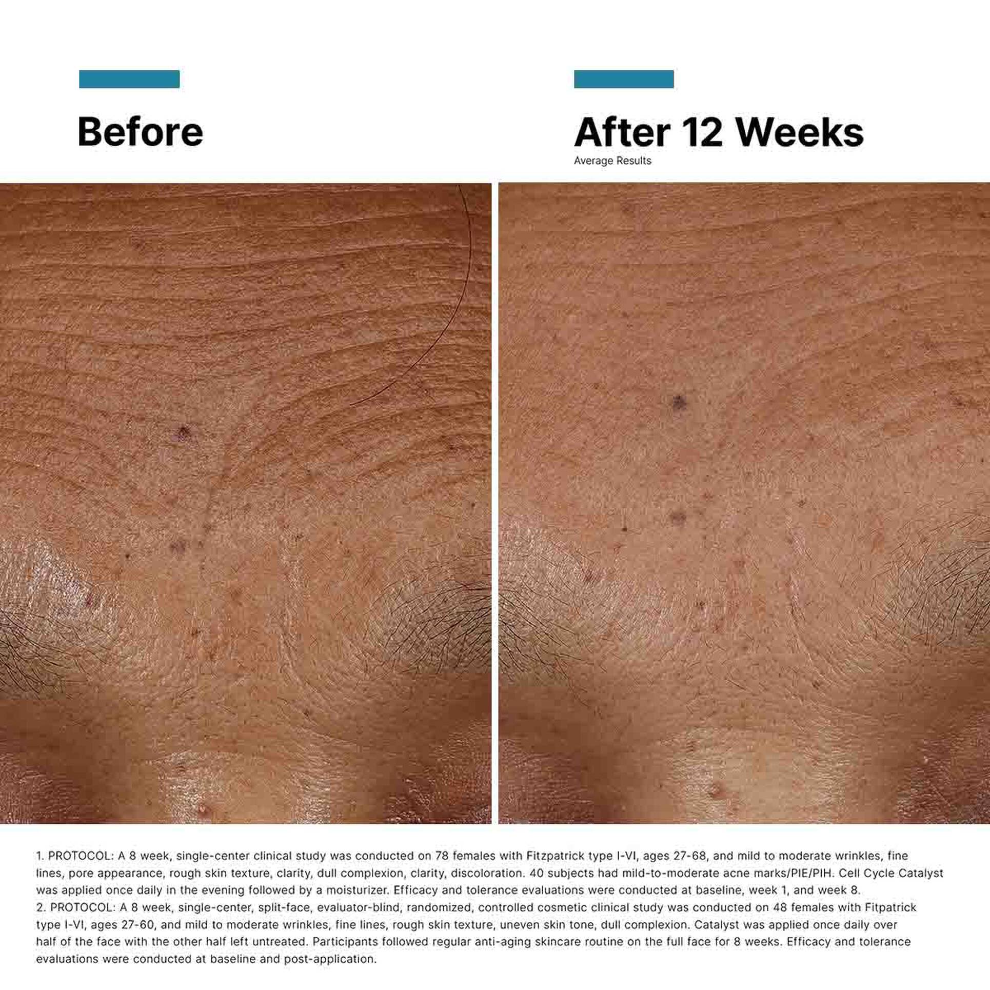 SkinCeuticals Hyaluronic Acid Intensifier Multi-Glycan