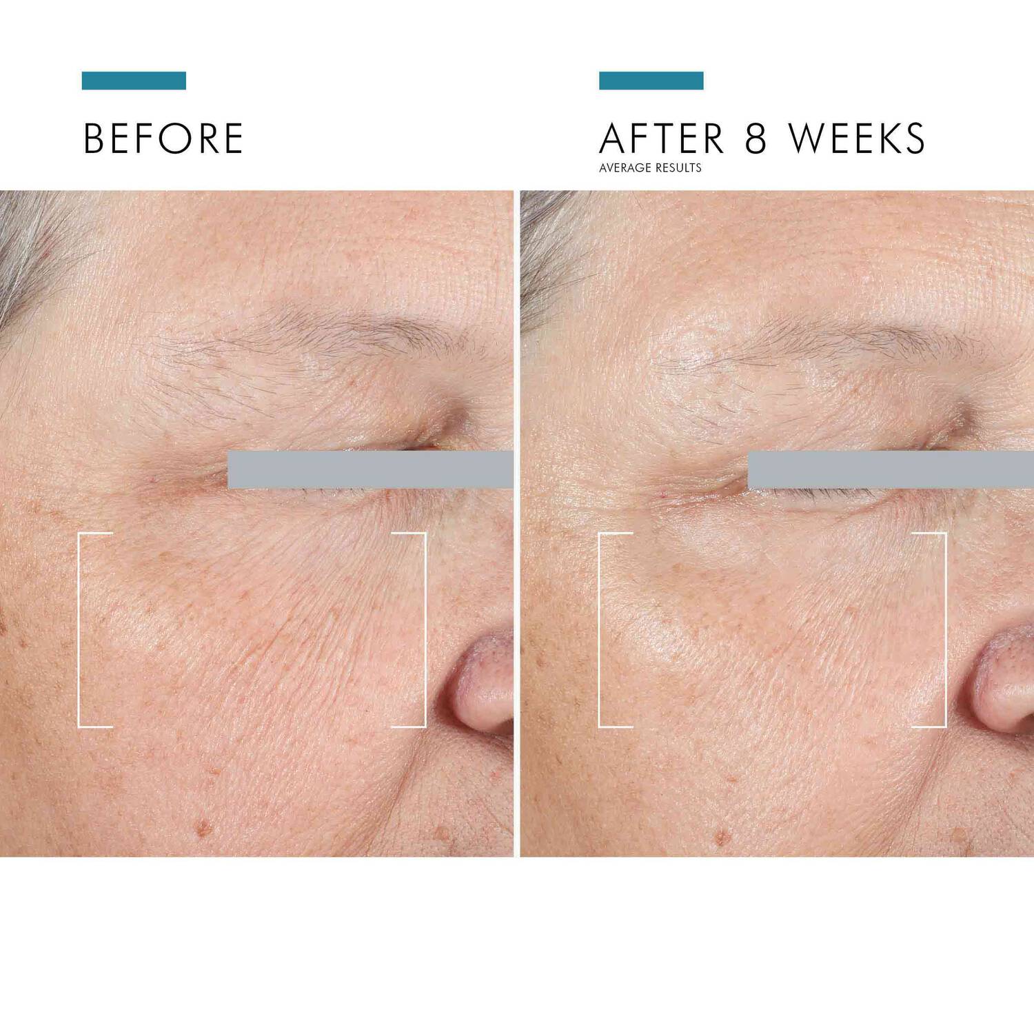 SkinCeuticals A.G.E. Advanced Eye for Dark Circles