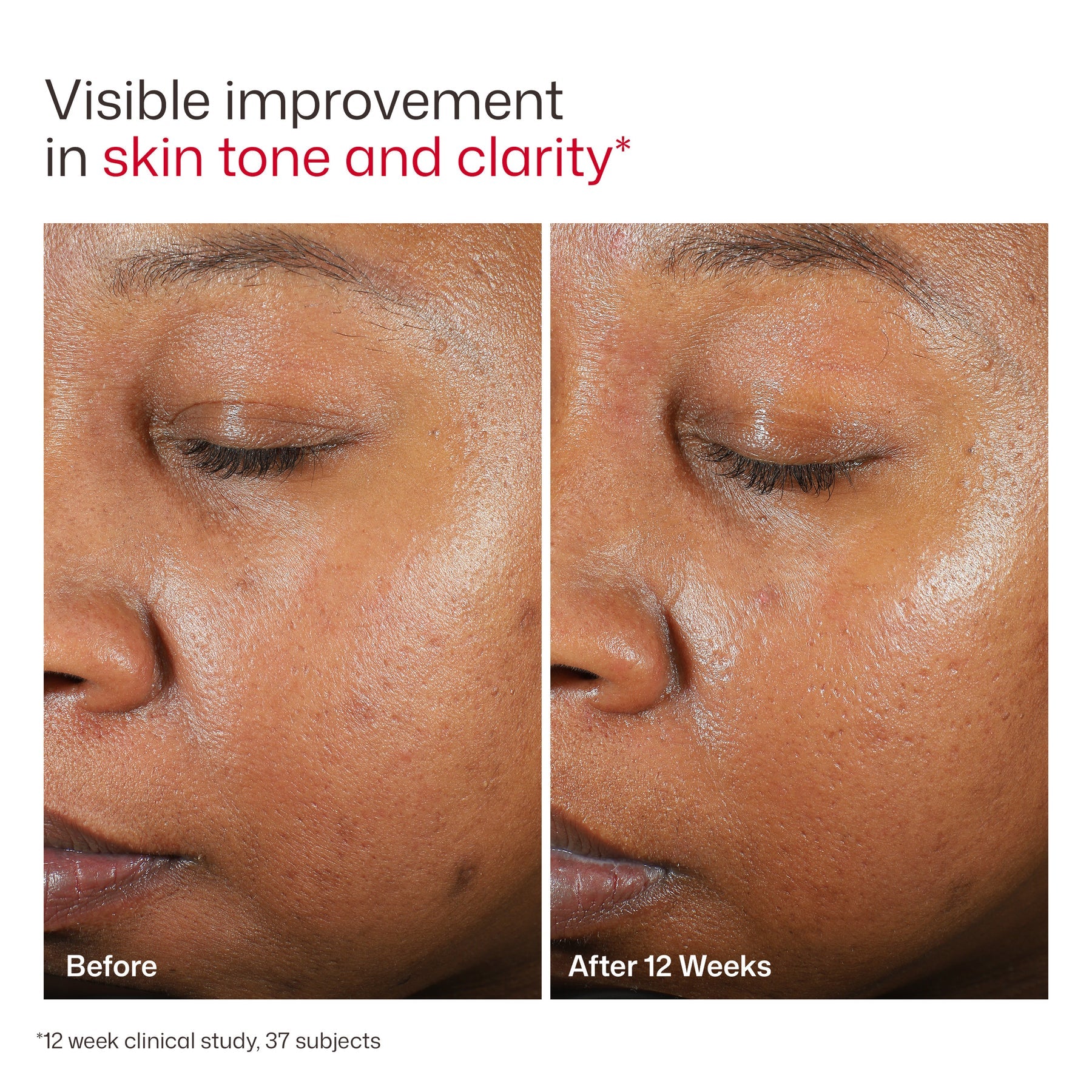 EltaMD UV Clear Tinted Broad Spectrum SPF 46